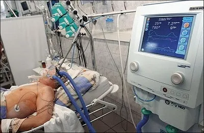 Обширний інсульт наслідки і шанси вижити (інсульт) Обширний інсульт наслідки і шанси вижити
