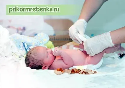 Обробка пупка новонародженого марганцівкою та хлорофіліпту (хлорофіліпту) Обробка пупка новонародженого марганцівкою і хлорофіліпту