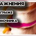 Операція при остеохондрозі показання і протипоказання (протипоказання) Операція при остеохондрозі показання і протипоказання