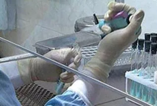 Досліди лікарів на собі найвідоміші випадки в медицині (лікарів) Досліди лікарів на собі найвідоміші випадки в медицині