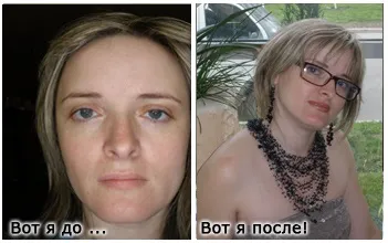 Відгуки про Плацентоль - МНПК біотехіндустрія (Плацентоль) Відгуки про Плацентоль - МНПК біотехіндустрія