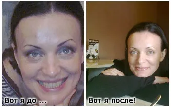 Відгуки про Плацентоль - МНПК біотехіндустрія (Плацентоль) Відгуки про Плацентоль - МНПК біотехіндустрія