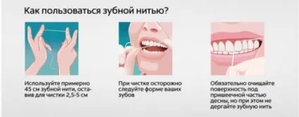 Пародонтоз причини виникнення у дорослих спадковість, інфекції