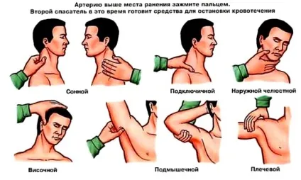 Пальцеве притиснення артерій перша допомога для зупинки артеріальної кровотечі