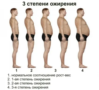 Ожиріння - причини, симптоми, діагностика та лікування (ожиріння) Ожиріння - причини, симптоми, діагностика та лікування