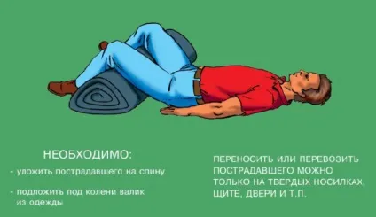 Перелом клубової кістки причини, симптоми, перша допомога та лікування (клубової) Перелом клубової кістки причини, симптоми, перша допомога та лікування