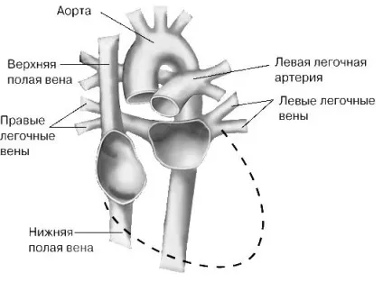 Пересадка органів - це