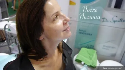 Пілінг для шкіри навколо очей