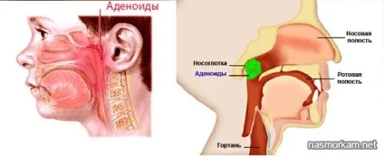 Білі соплі у дітей і дорослих що це означає лікування