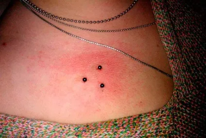 Площинний пірсинг ключиці, живота і особи (пірсинг) Площинний пірсинг ключиці, живота і особи