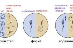 Чому яєчка піднімаються вгору патологія це або норма (вгору) Чому яєчка піднімаються вгору патологія це або норма