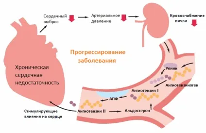 Правожелудочковаянедостатність серця симптоми і лікування (серця) Правожелудочковаянедостатність серця симптоми і лікування