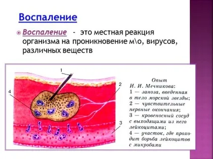 Презентація «боротьба організму з інфекцією (Вірус грипу Вірус грипу) Презентація «боротьба організму з інфекцією