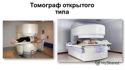 Презентація на тему магнітно резонансна томографія (презентація) Презентація на тему магнітно резонансна томографія