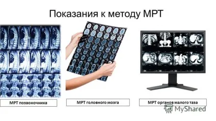 Презентація на тему магнітно резонансна томографія (магнітно-резонансна томографія. Один з найбільш популярних методів сучасної діагностики людини. За 40 років існування мрт зуміла зарекомендувати.) Презентація на тему магнітно резонансна томографія