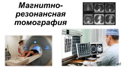 Презентація на тему магнітно резонансна томографія (томографія) Презентація на тему магнітно резонансна томографія