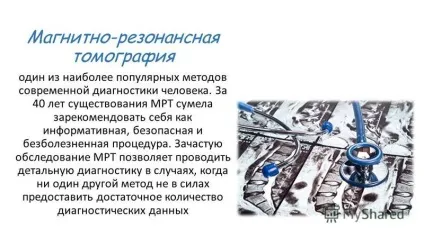 Презентація на тему магнітно резонансна томографія (презентація) Презентація на тему магнітно резонансна томографія
