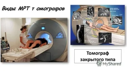 Презентація на тему магнітно резонансна томографія (магнітно) Презентація на тему магнітно резонансна томографія