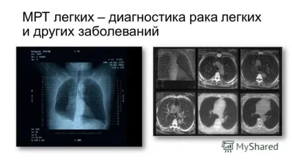 Презентація на тему магнітно резонансна томографія (томографія) Презентація на тему магнітно резонансна томографія