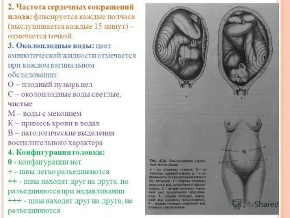 Презентація на тему п артограмма