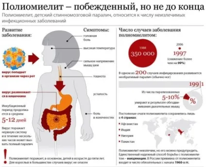Щеплення від поліомієліту наслідки, можливі побічні реакції, скільки щеплень роблять до року, (поліомієліту) Щеплення від поліомієліту наслідки, можливі побічні реакції, скільки щеплень роблять до року,