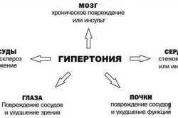 Прогноз життя при серцевій недостатності (прогноз) Прогноз життя при серцевій недостатності