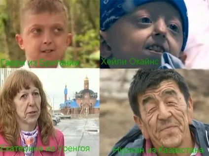 Прогерія, або синдром передчасного старіння, сайт для тих, кому за сорок (прогерія) Прогерія, або синдром передчасного старіння, сайт для тих, кому за сорок