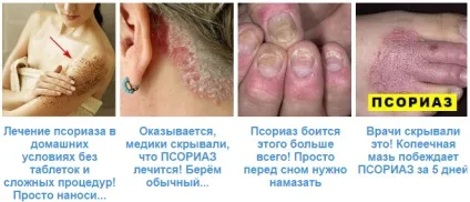 Псоріаз і алкоголь що можна (алкоголь) Псоріаз і алкоголь що можна