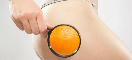 Швидка дієта від целюліту - які продукти виключити (які) Швидка дієта від целюліту - які продукти виключити