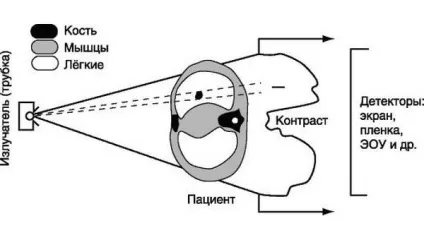 Рентген черевної порожнини (черевної) Рентген черевної порожнини
