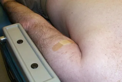 Родимка, родима пляма - причини, симптоми і лікування (родимка родима пляма) Родимка, родима пляма - причини, симптоми і лікування