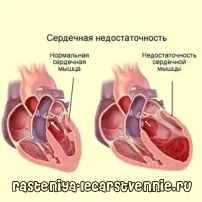 Серцева недостатність лікування препарати - лікування серця (серцева) Серцева недостатність лікування препарати - лікування серця