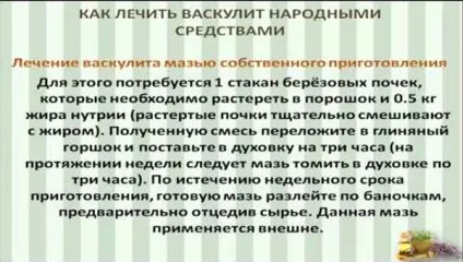 Лікування васкуліту народними засобами - геморагічного, нижніх кінцівок, на ногах, (народними) Лікування васкуліту народними засобами - геморагічного, нижніх кінцівок, на ногах,