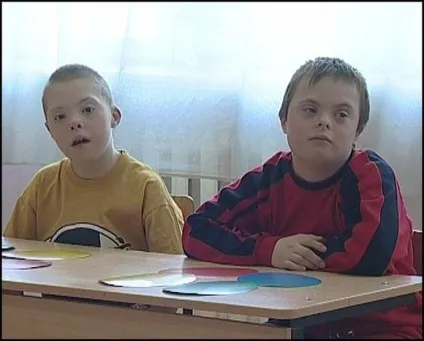 Зайва хромосома у людини хромосомні хвороби людини, два апельсина (хвороби) Зайва хромосома у людини хромосомні хвороби людини, два апельсина