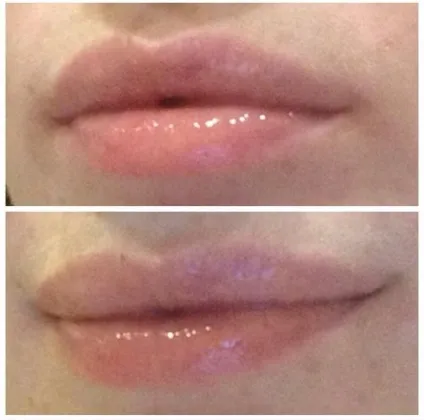 Блиск для збільшення обсягу губ minty kiss від victoria - s secret - відгуки про косметику (макіяж) Блиск для збільшення обсягу губ minty kiss від victoria - s secret - відгуки про косметику
