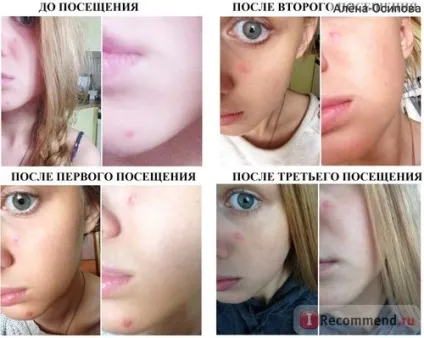Солярій - «не рекомендую, але якщо вже зважилися то робіть це правильно! », Відгуки покупців (правильно) Солярій - «не рекомендую, але якщо вже зважилися то робіть це правильно!