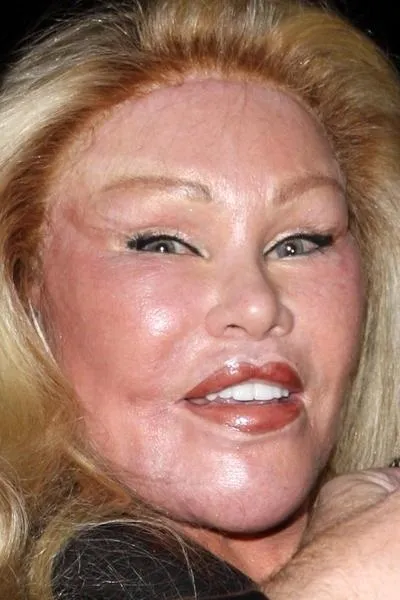 Старі зірки, спотворила себе пластикою, умкра (сталлоне) Старі зірки, спотворила себе пластикою, умкра