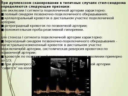 Steal- синдром як часто ви вимірюєте своїм (steal) Steal- синдром як часто ви вимірюєте своїм