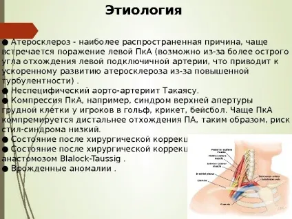 Steal- синдром як часто ви вимірюєте своїм (своєю) Steal- синдром як часто ви вимірюєте своїм