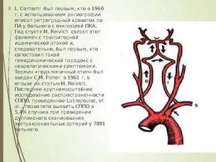 Steal- синдром як часто ви вимірюєте своїм
