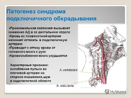 Steal- синдром як часто ви вимірюєте своїм (вимірюєте) Steal- синдром як часто ви вимірюєте своїм