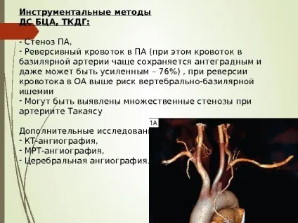 Steal- синдром як часто ви вимірюєте своїм (синдром) Steal- синдром як часто ви вимірюєте своїм