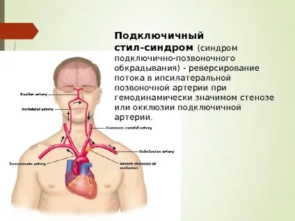 Steal- синдром як часто ви вимірюєте своїм