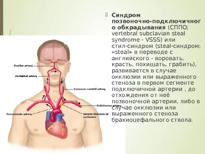 Steal- синдром як часто ви вимірюєте своїм