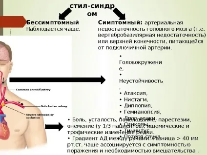 Steal- синдром як часто ви вимірюєте своїм (вимірюєте) Steal- синдром як часто ви вимірюєте своїм