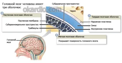 Субарахноїдальний крововилив що це, причини, лікування, наслідки