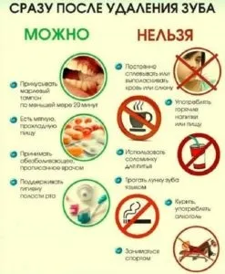 Чи боляче вставляти імплант зуба (вставляти) Чи боляче вставляти імплант зуба