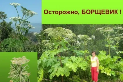 Борщівник фото, як лікувати опіки (лікувати) Борщівник фото, як лікувати опіки