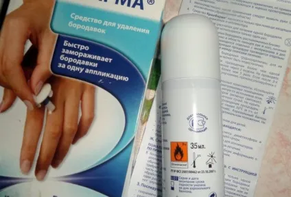 Бородавка на долоні; причини її появи і способи лікування (долоні) Бородавка на долоні; причини її появи і способи лікування