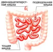 Тонкий кишечник, стінки тонкого кишечника, ілеоцекальний клапан (кишечник) Тонкий кишечник, стінки тонкого кишечника, ілеоцекальний клапан